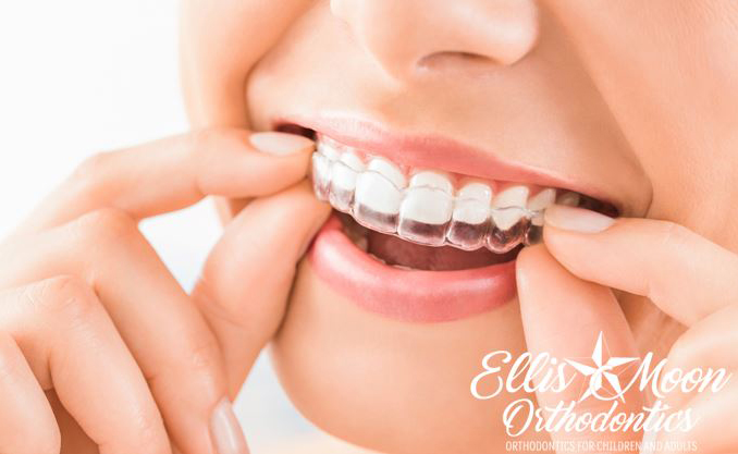 Invisalign-w-logo
